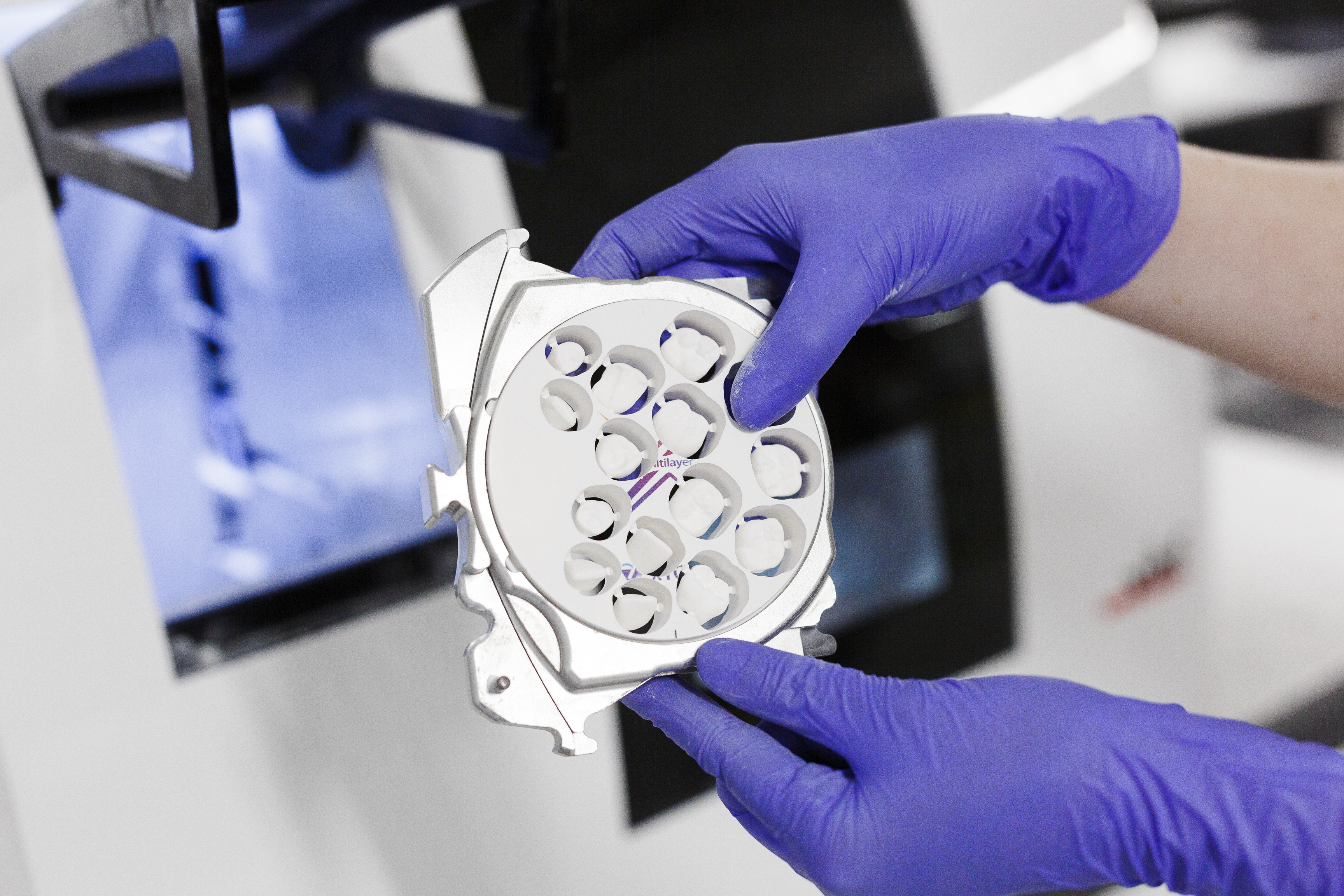 A dental technician wearing purple nitrile gloves inspects a white 3D-printed dental model showing multiple tooth positions, with CAD software displayed on a computer monitor in the background.