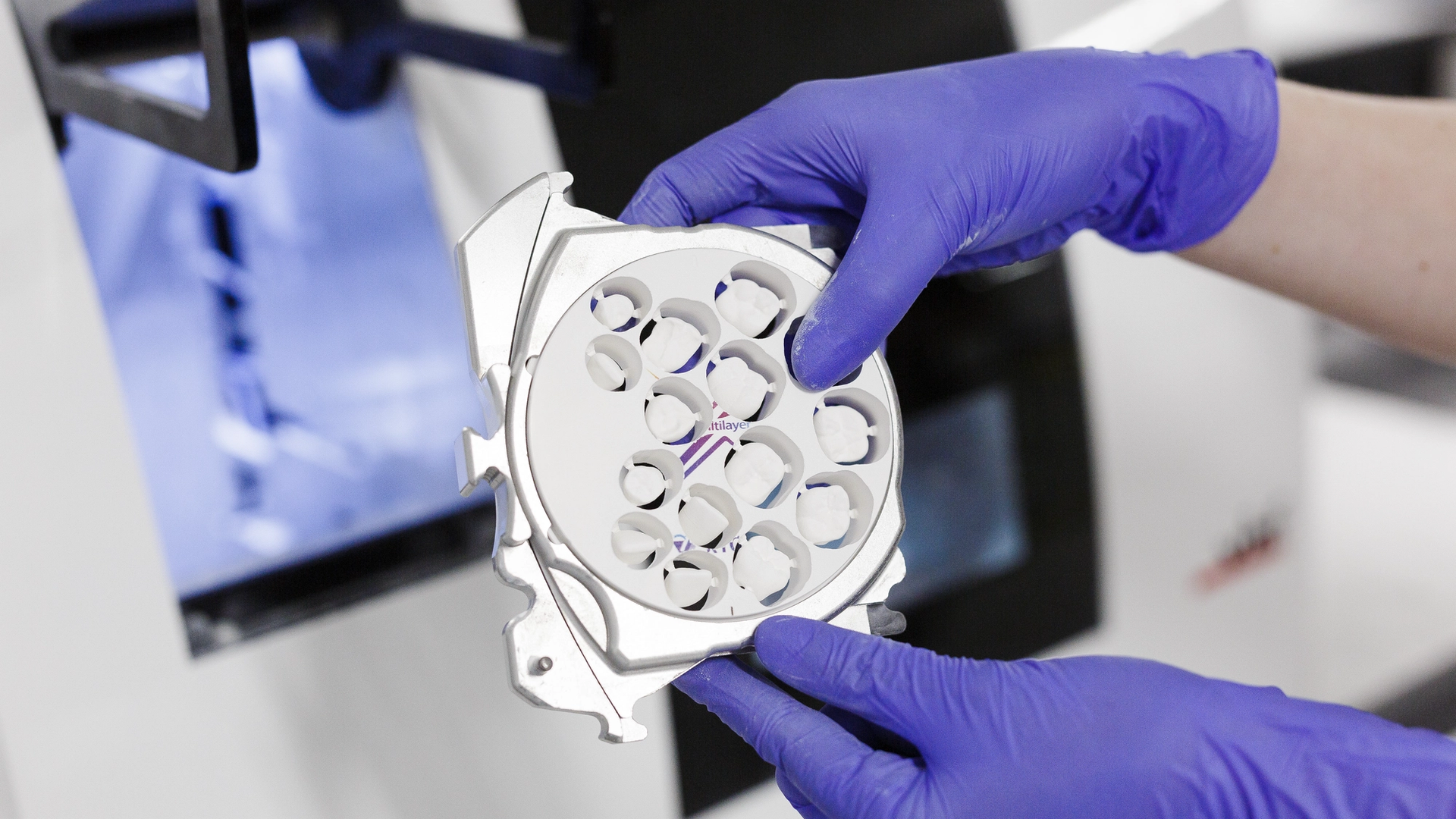A dental technician wearing purple nitrile gloves inspects a white 3D-printed dental model showing multiple tooth positions, with CAD software displayed on a computer monitor in the background.