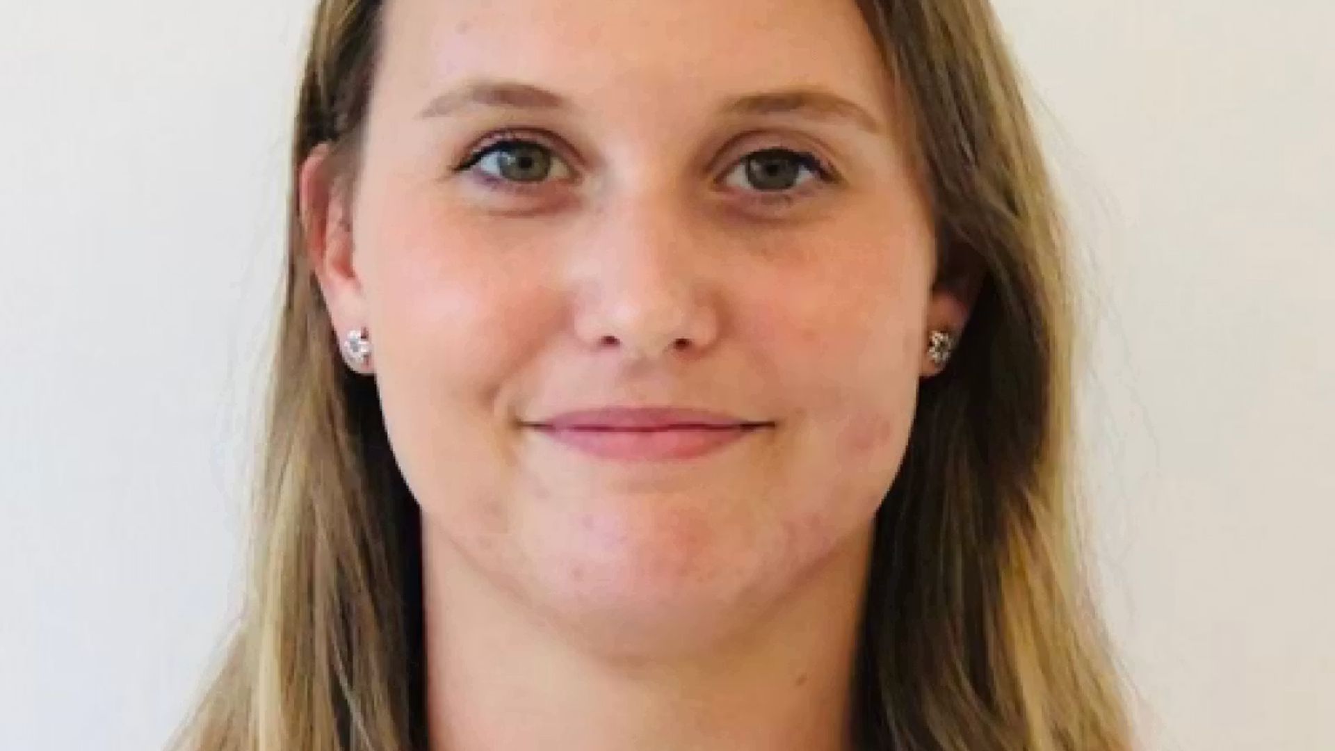 Image of a woman smiling without her teeth showing