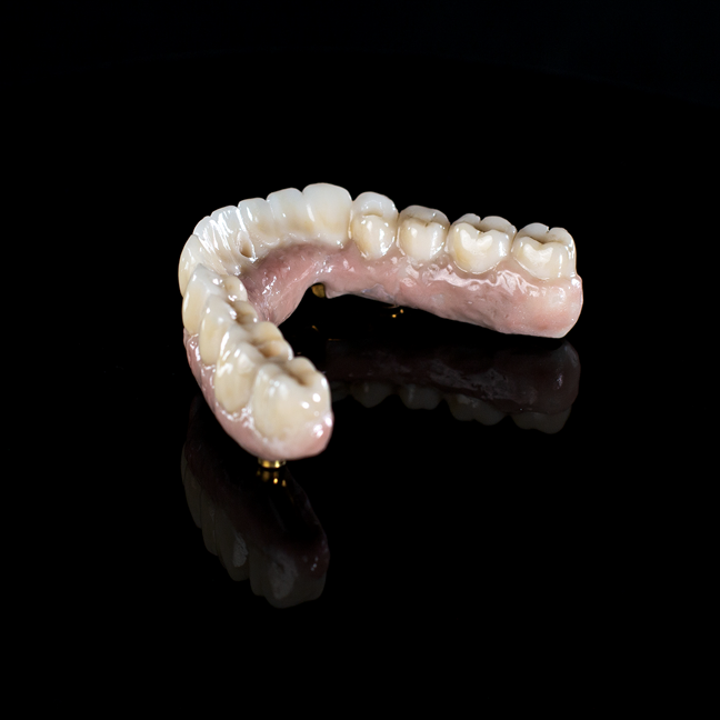 A complete maxillary and mandibular denture prosthesis with natural-looking ceramic teeth and pink acrylic base displayed against a black background.