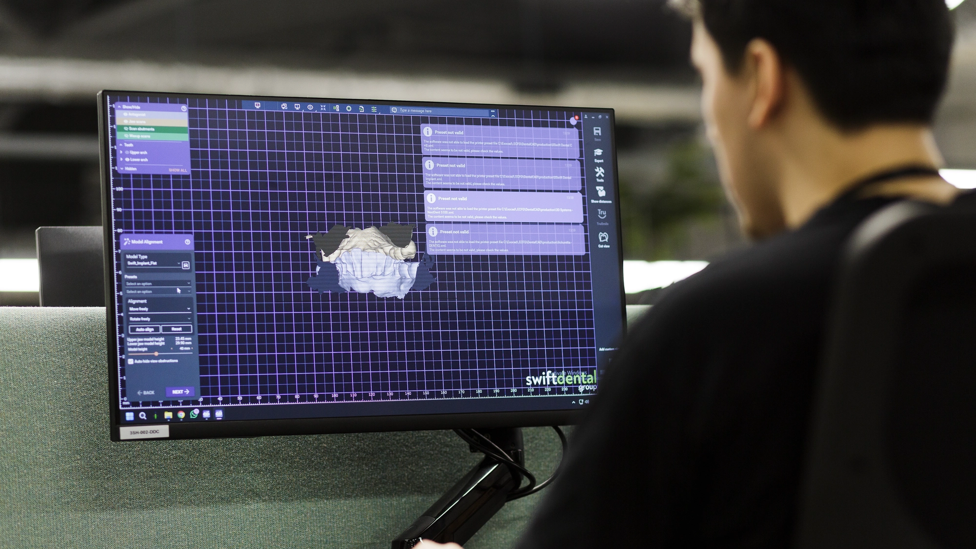 A dental technician views a computer screen displaying Swift Dental software with a 3D digital model of a dental arch rendered on a blue grid interface for designing dental prosthetics and restorations.
