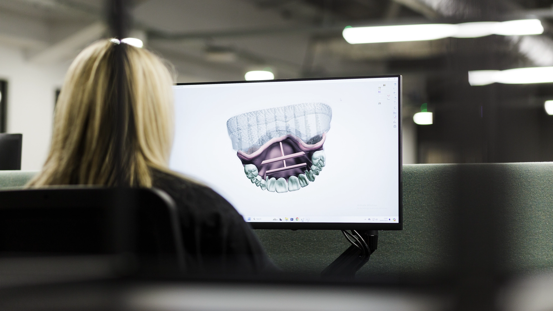 A dental technician views a computer monitor displaying a 3D digital model of a dental implant with jawbone anatomy and surgical planning visualization in a modern dental laboratory.