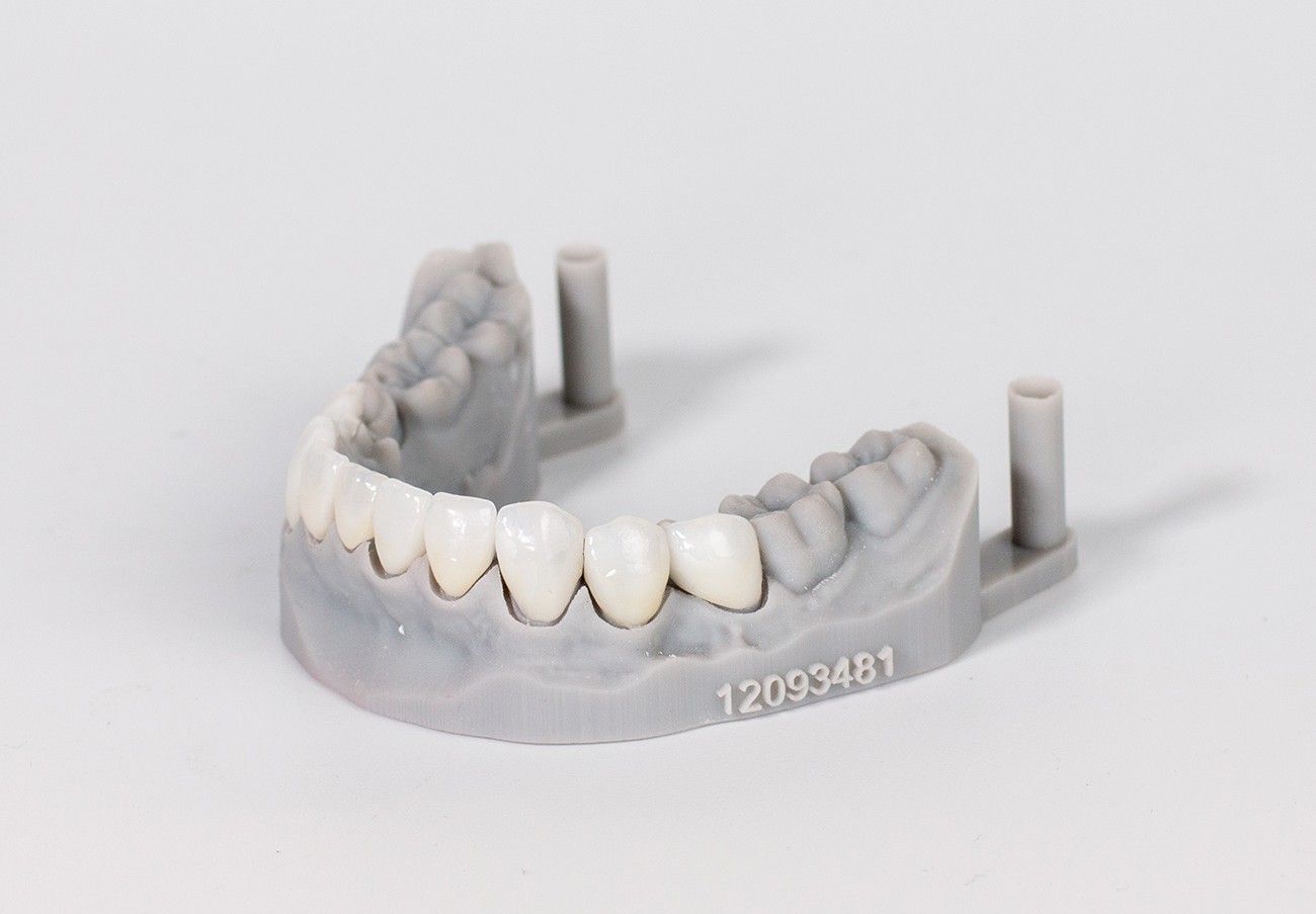 set of veneers