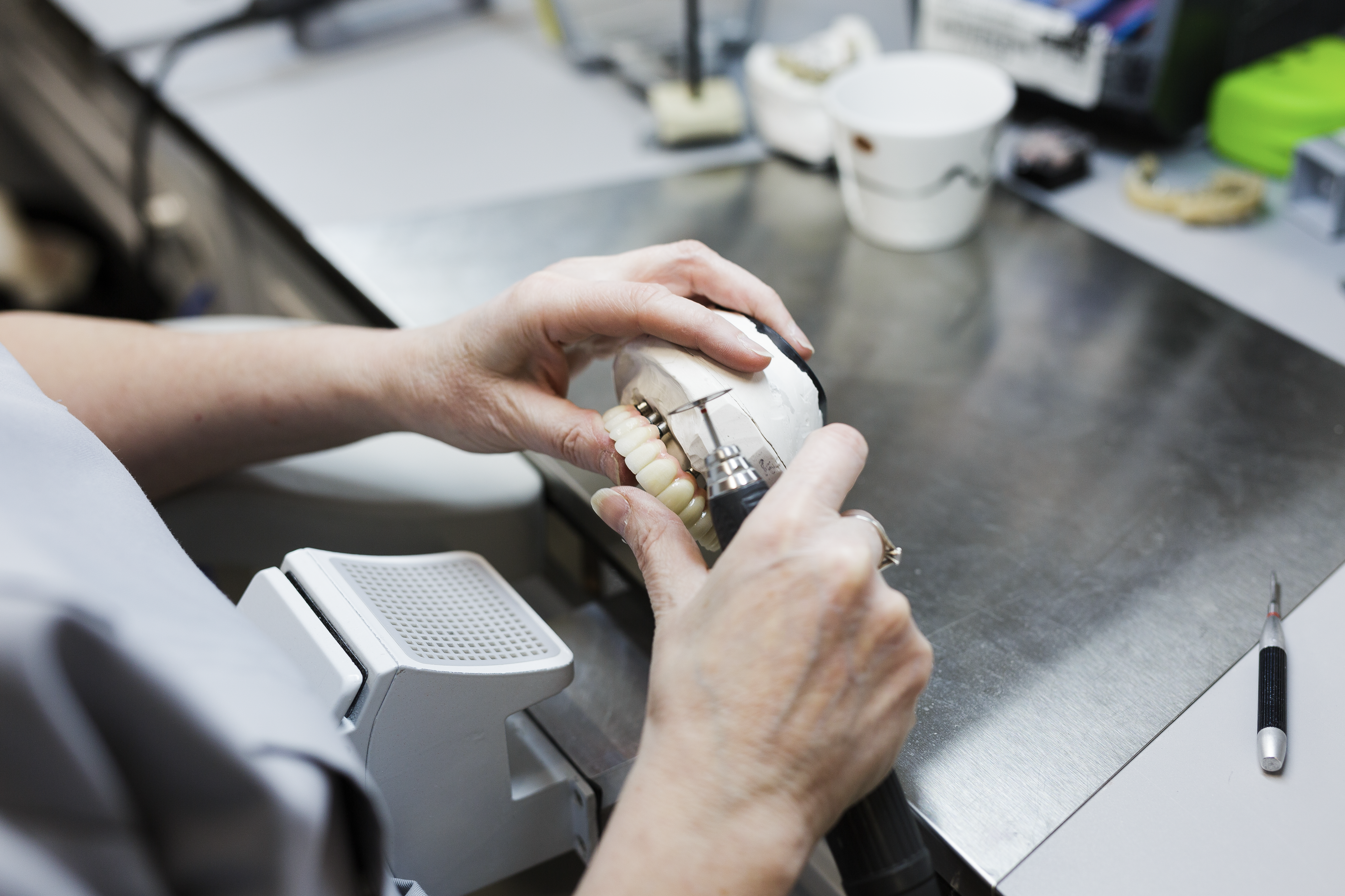 A dental laboratory technician holds and inspects a ceramic dental crown with tooth-colored restoration mounted on an articulator model, examining the fit and esthetics at a laboratory workstation.