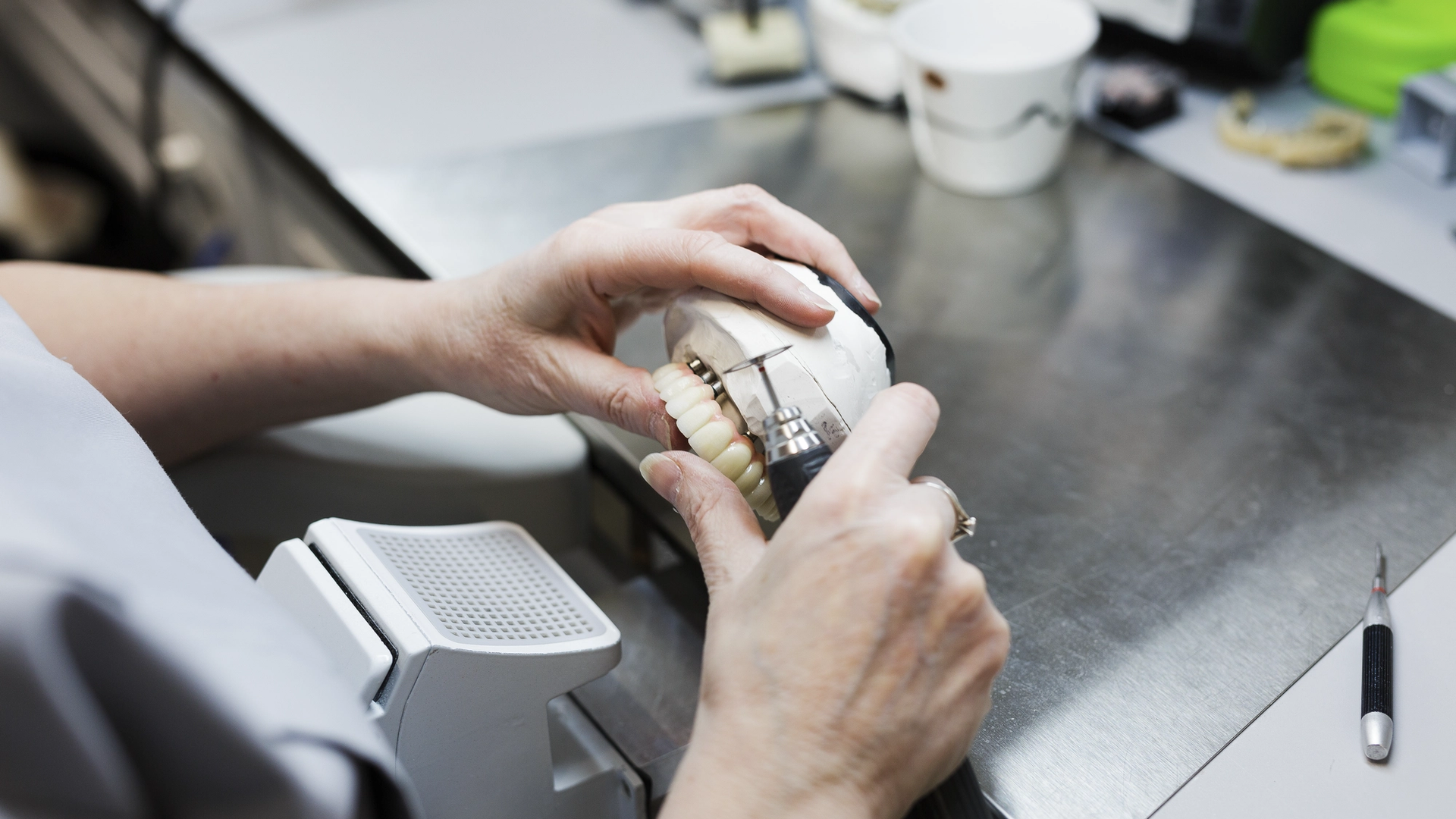 A dental laboratory technician holds and inspects a ceramic dental crown with tooth-colored restoration mounted on an articulator model, examining the fit and esthetics at a laboratory workstation.