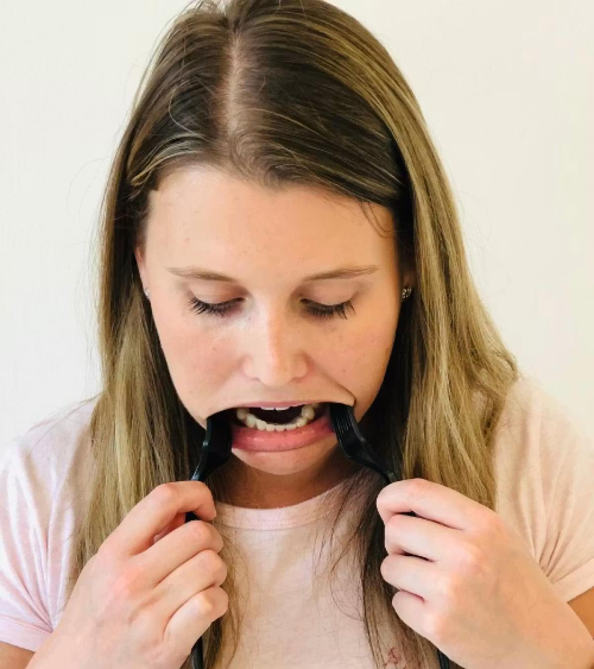 A woman holding two spoons pushing her lower lip down. Her lower arch is visible
