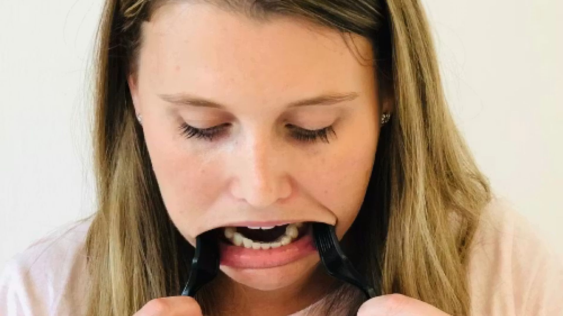 A woman holding two spoons pushing her lower lip down. Her lower arch is visible