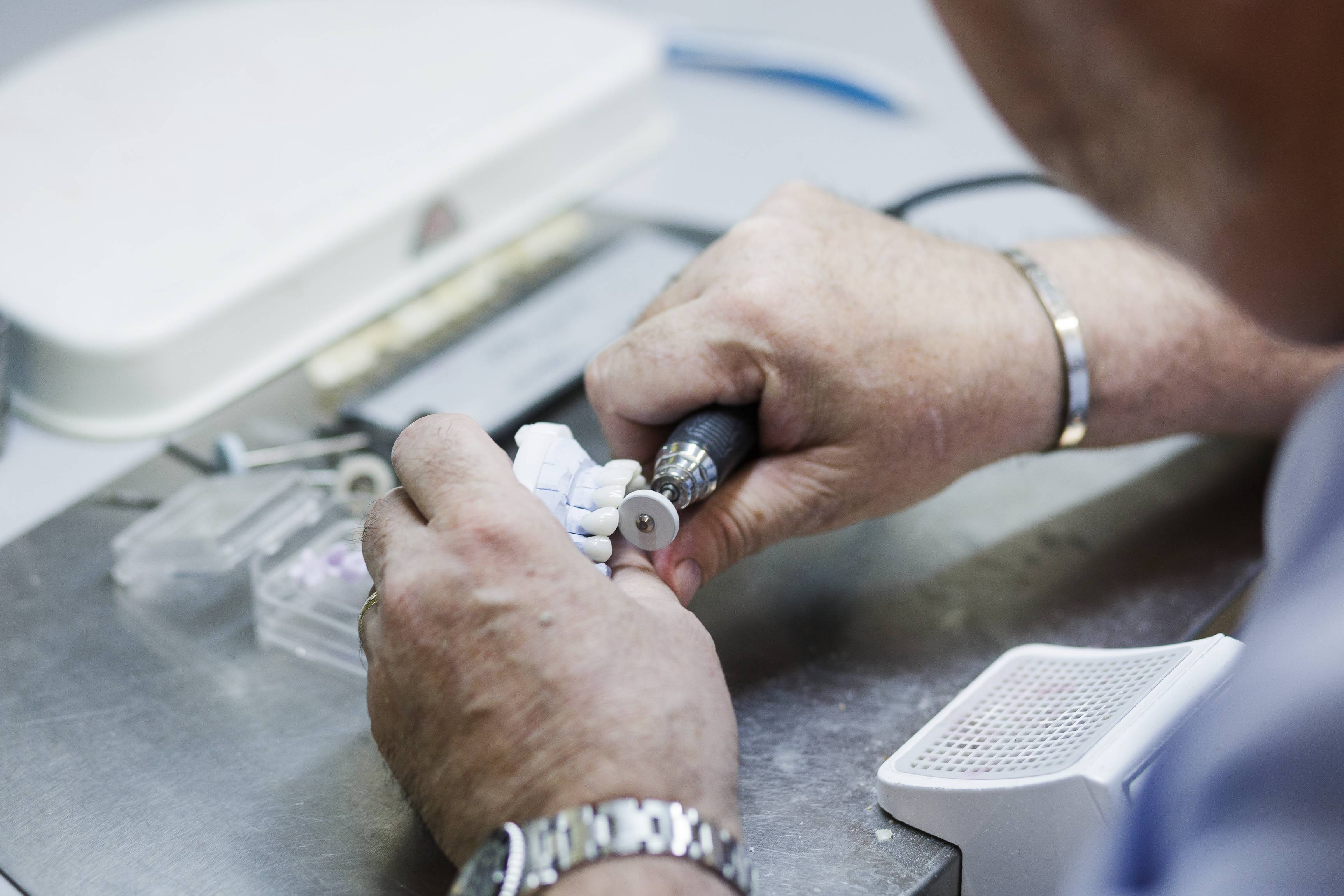 A dental technician holds a white ceramic zirconia abutment attached to a dental implant handpiece during laboratory fabrication of a tooth restoration.