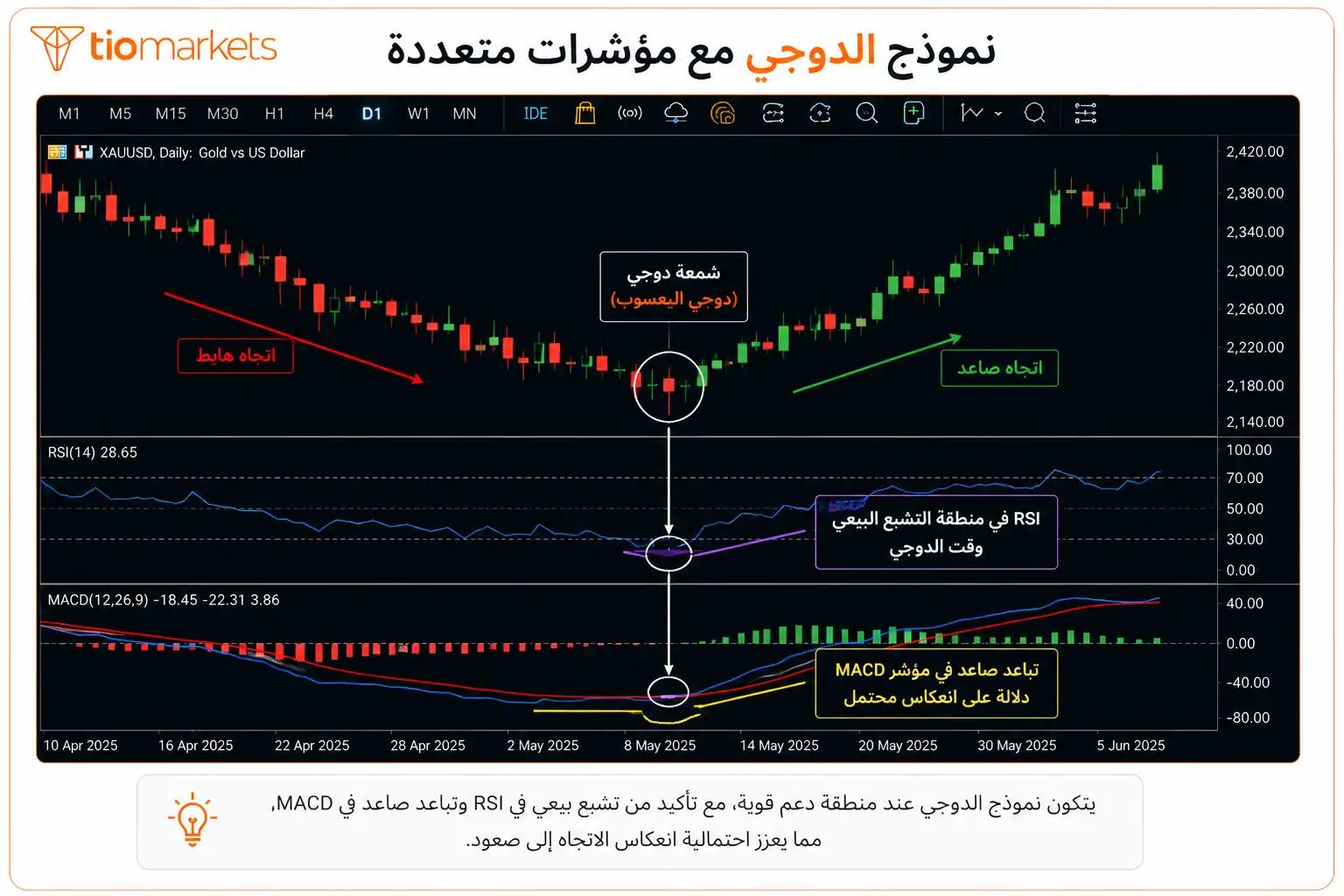 تأكيد نموذج الدوجي بمؤشرات RSI و MACD ومستويات الدعم