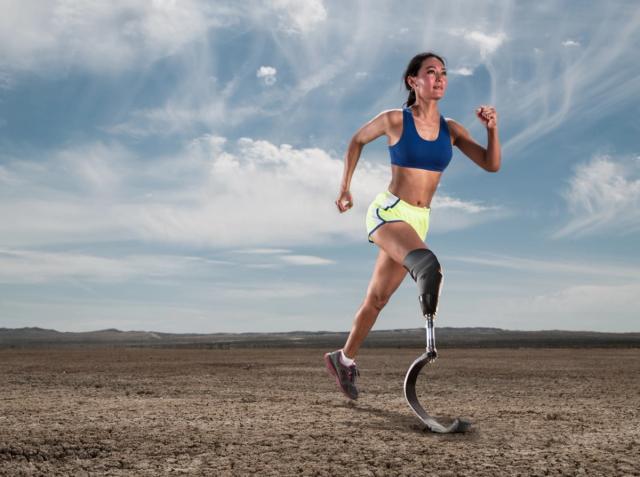 Amputee Rehabilitation
