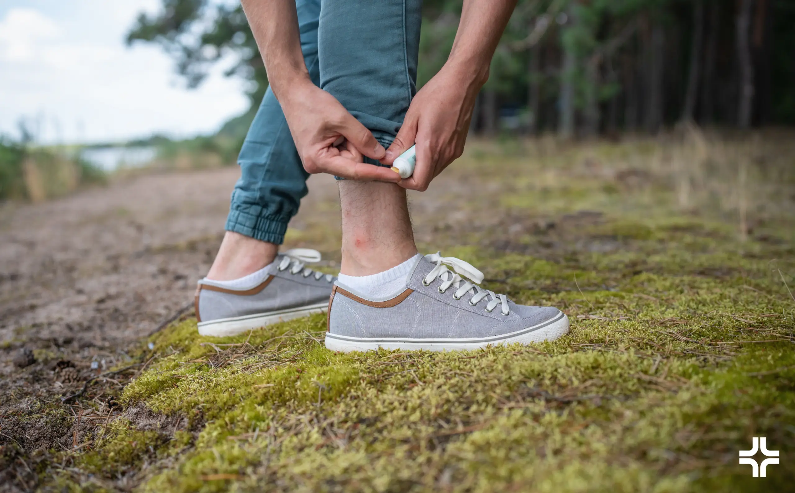 Hiker rolls up pants to apply cream to an itchy ankle