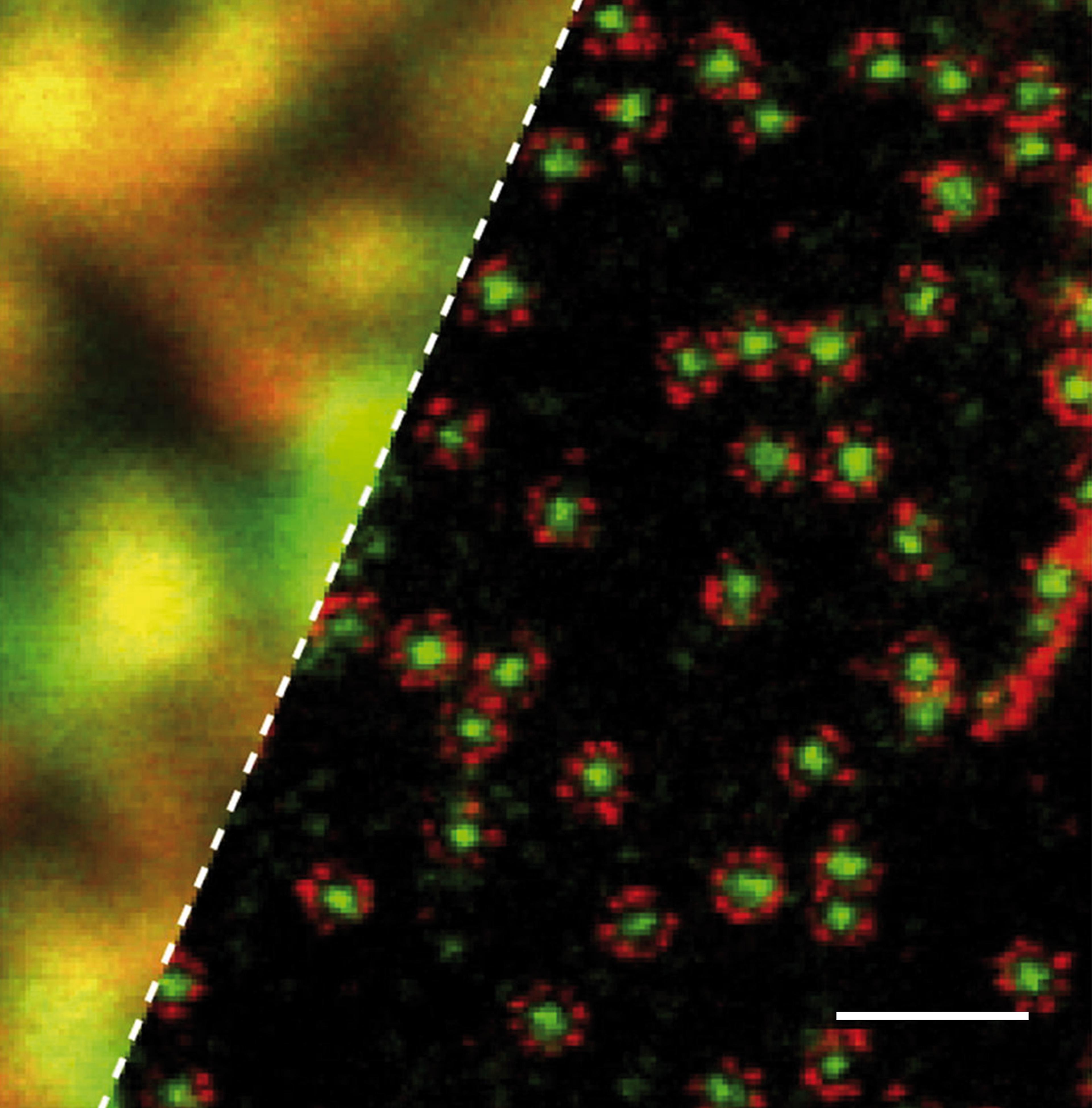 STED microscopy image of protein complexes (right), revealing a much higher resolution than conventional confocal microscopy (left)