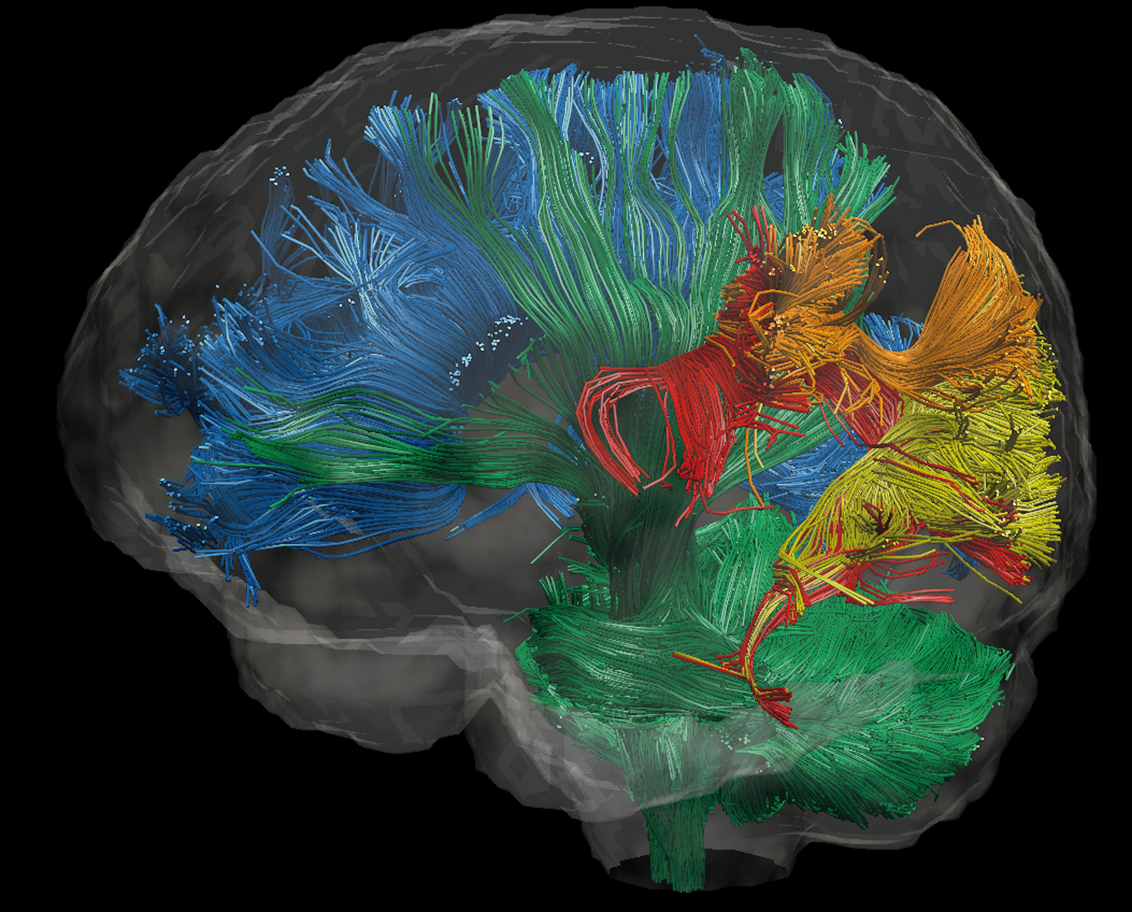 The brain is made up of different regions, each with specialised functions: White matter tracts throughout the human brain