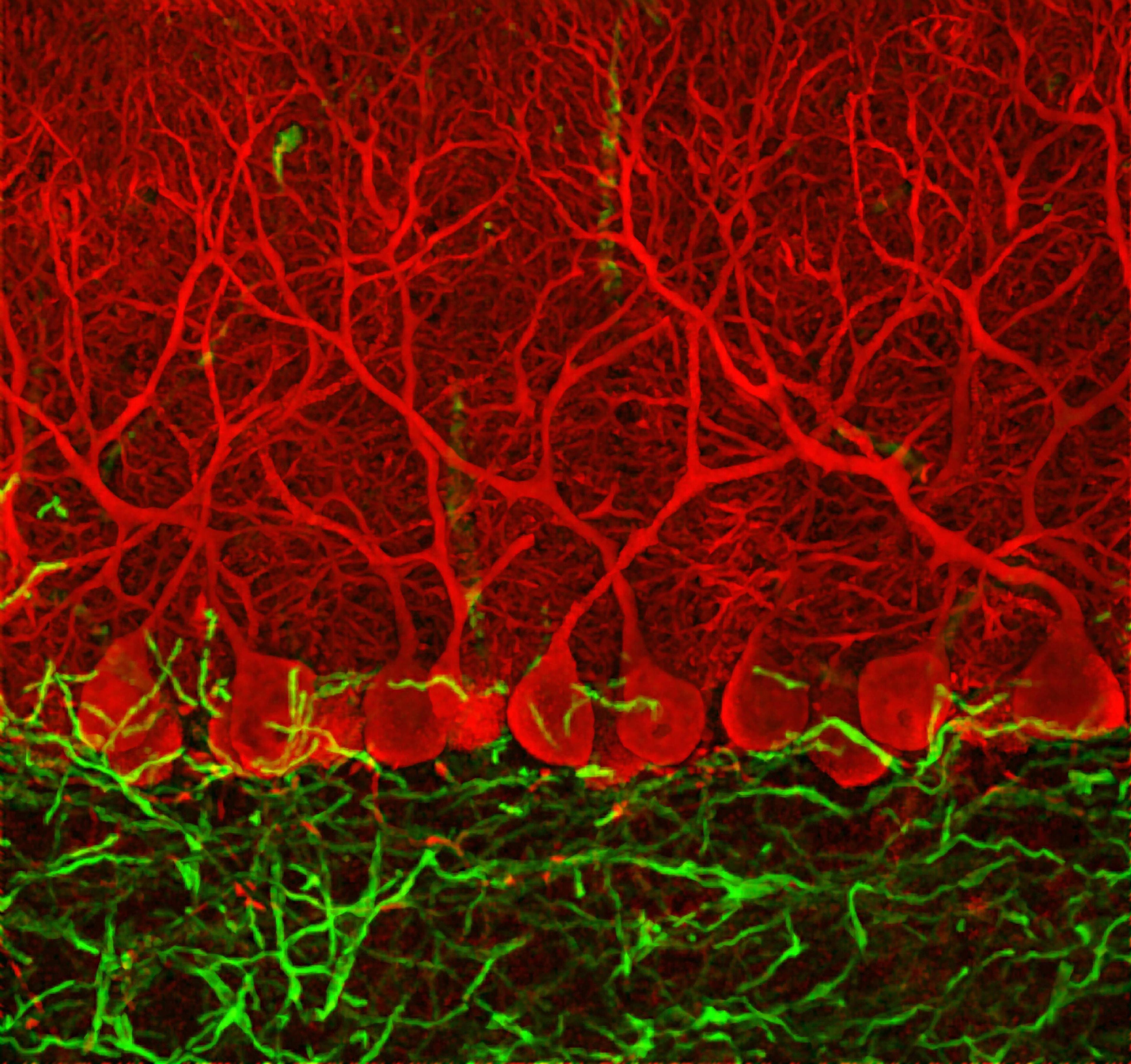Purkinje cells (red) of the cerebellum, a brain region involved in voluntary movement, are easy to recognize because of their elaborate branches. The cells degenerate in spinocerebellar ataxia 1 (SCA1), an inherited disease caused by mutations in the ATXN1 gene. Harry Orr and Huda Zoghbi independently discovered the gene in 1993. As collaborators, they have worked out how the mutations lead to the degeneration of Purkinje cells in people with SCA1. Credit: Ludovic Collin. Attribution-NonCommercial 4.0 International (CC BY-NC 4.0)