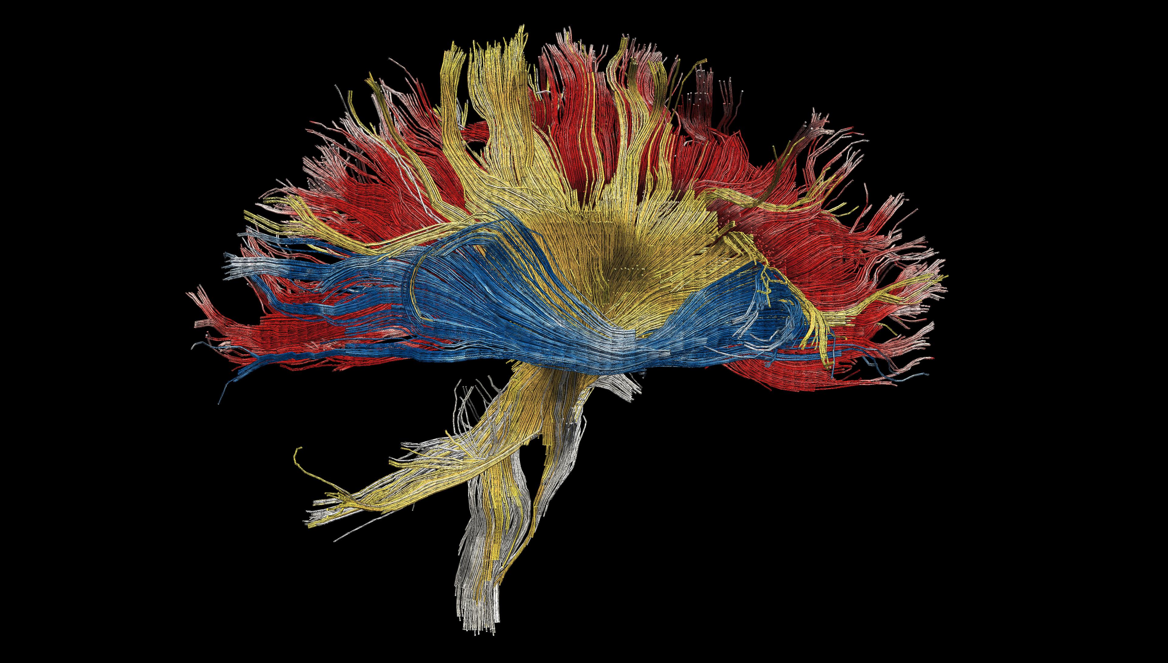 Imaging can reveal the flow of information in the brain: MRI-based imaging of six of the major white matter pathways in the human brain 