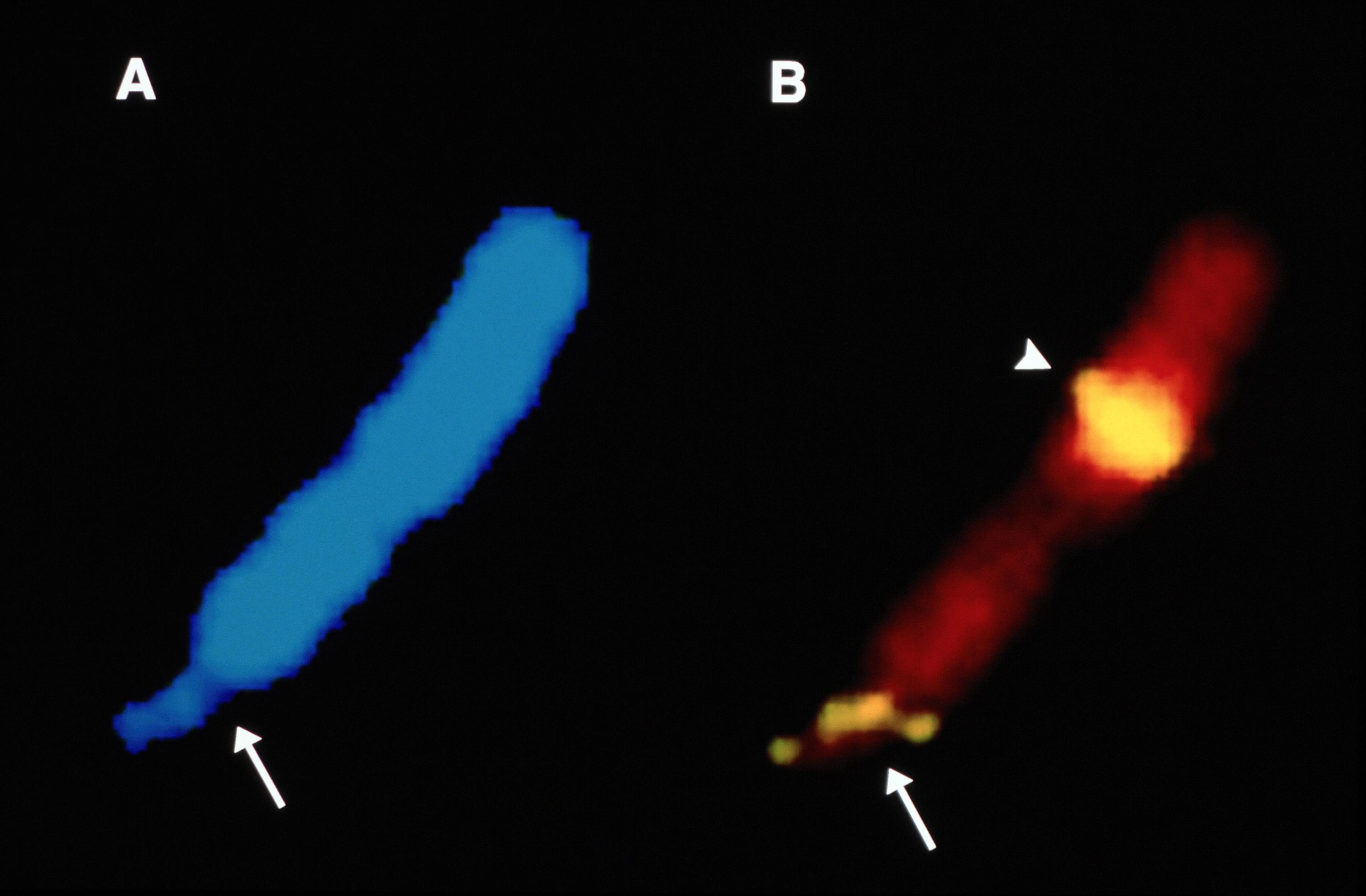 Fragile X syndrome is caused by an unusual mutation on the FMR1 gene. The mutation consists of a three-letter DNA repeat that causes structural changes, toward the end of X chromosome, that can be seen with the naked eye. The arrows mark the fragile sites on the chromosomes. Credit: Dr. Ben Oostra (CC0 1.0 Universal)