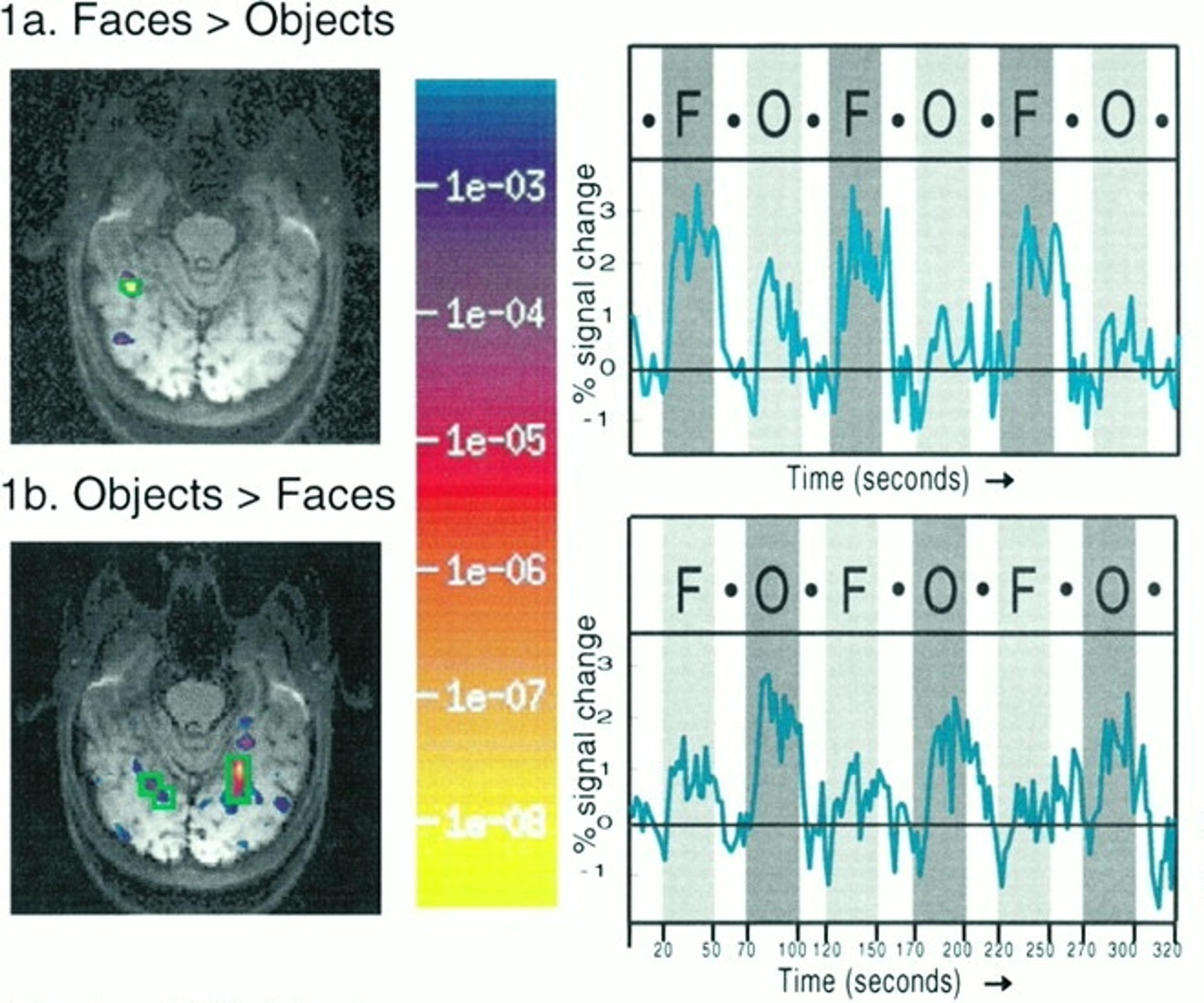 In Kanwisher’s seminal findings, functional brain imaging reveals an area in the right hemisphere (green, shown on left in 1a) that responds much more strongly to faces (F) than objects (O). Credit: Kanwisher, N., McDermott, J., & Chun, M. M. (1997).The fusiform face area: A module in human extrastriate cortex specialized for face perception. Journal of Neuroscience, 17(11), 4302–4311.Copyright 1997 Society for Neuroscience.