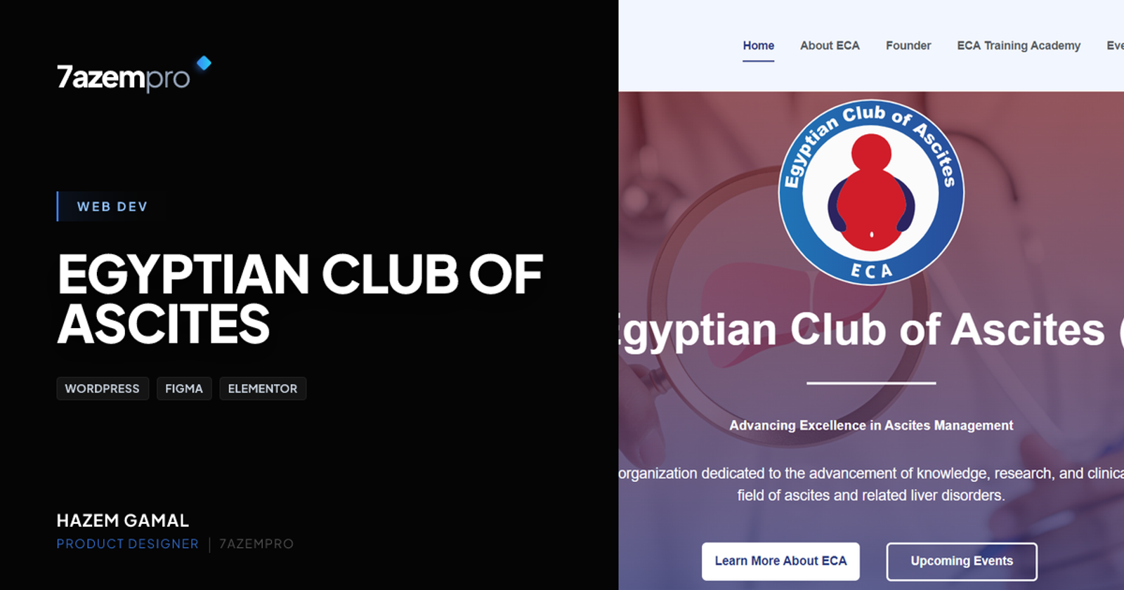 Egyptian Club of Ascites