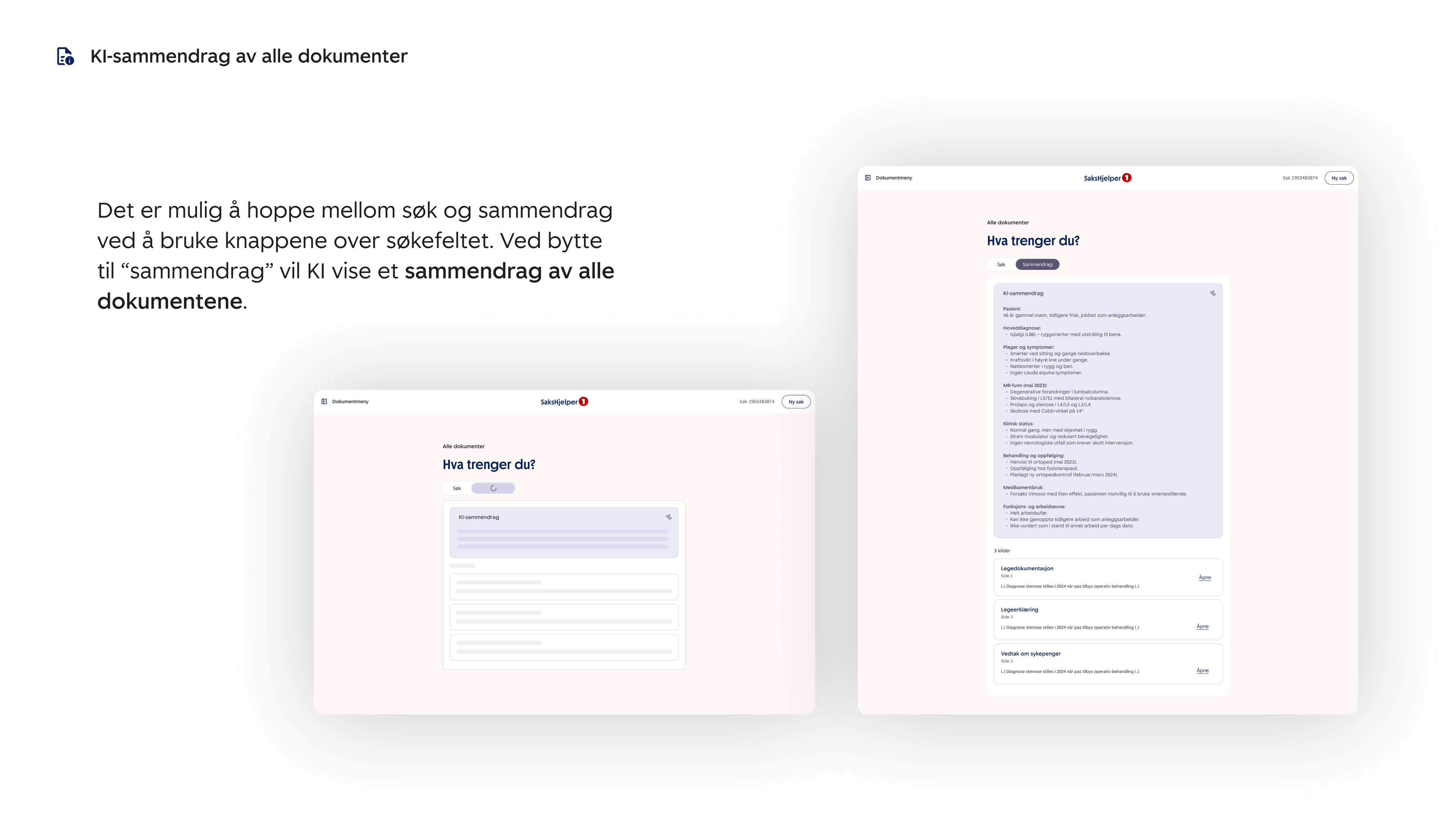 Det er mulig å hoppe mellom søk og sammendrag ved å bruke knappene over søkefeltet. Ved bytte til “sammendrag” vil KI vise et sammendrag av alle dokumentene.