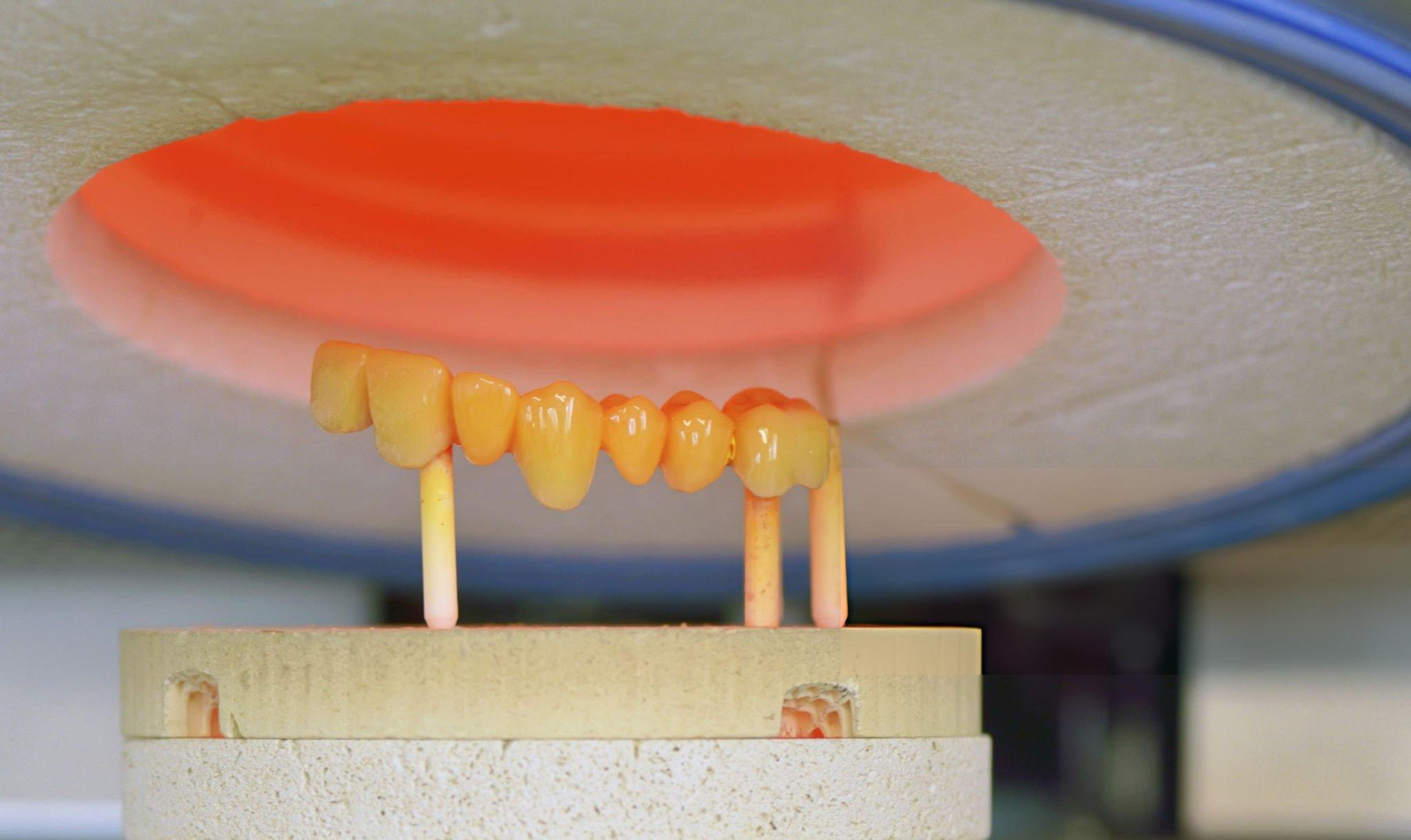 Close-up of teeth positioned in a dental furnace, illustrating the technology utilized for dental treatments.