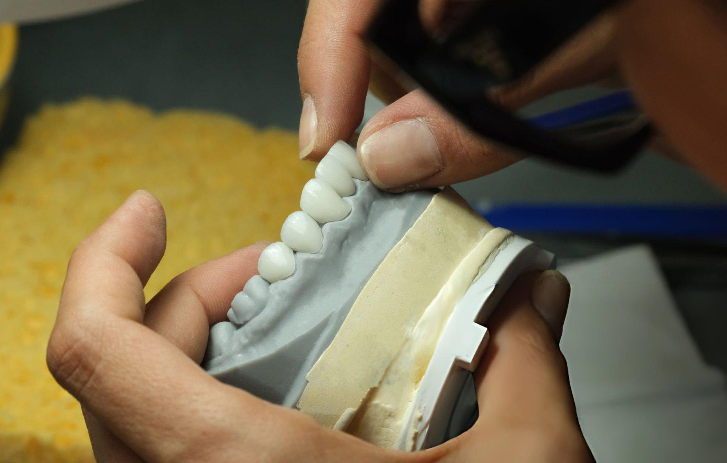 A dental technician is engaged in the final stage of the zirconia sintering process, focusing on quality control in dental fabrication