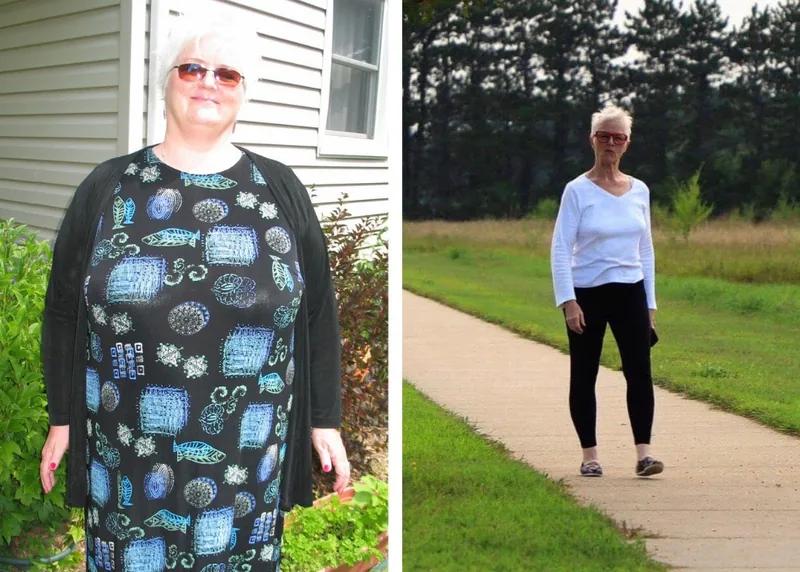 Teressa transformation