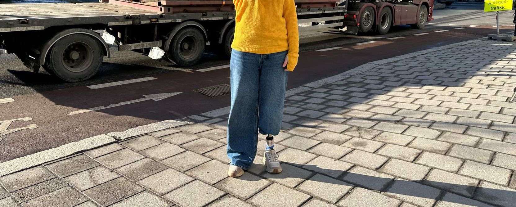 Person med benprotese