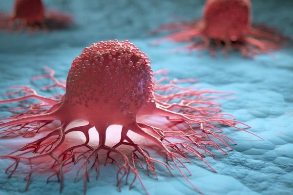 In Which Types of Cancer Is Immunotherapy Used? In Which Types of Cancer Is Immunotherapy Used?