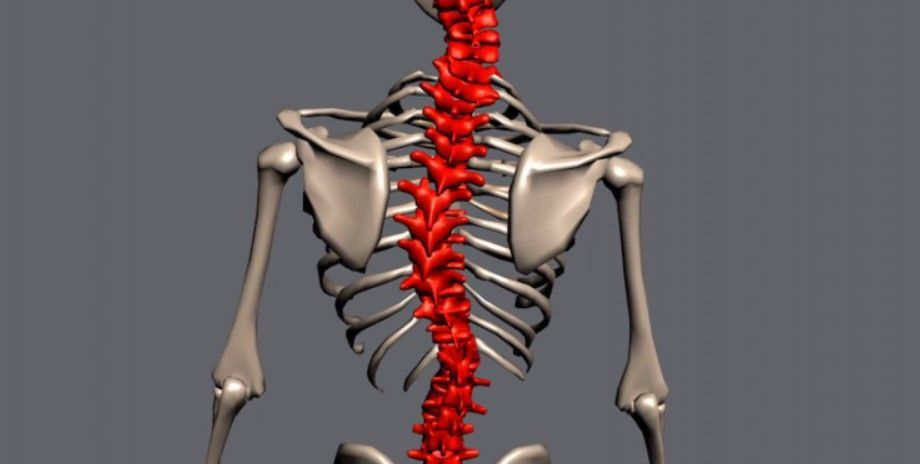 Does Scoliosis Cause Daily Fatigue?