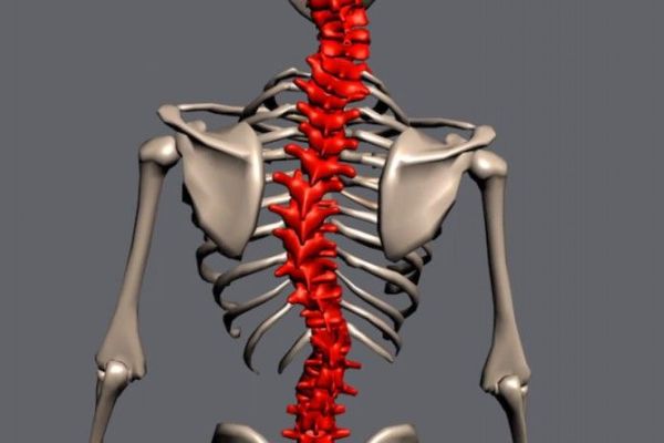 Does Scoliosis Cause Daily Fatigue? Does Scoliosis Cause Daily Fatigue?