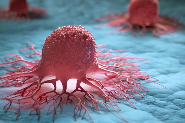 Dans Quels Types De Cancer L’Immunothérapie Est-Elle Utilisée?