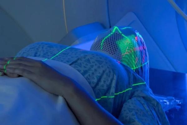 Quels Sont Les Effets Secondaires De La Radiothérapie? Quels Sont Les Effets Secondaires De La Radiothérapie?