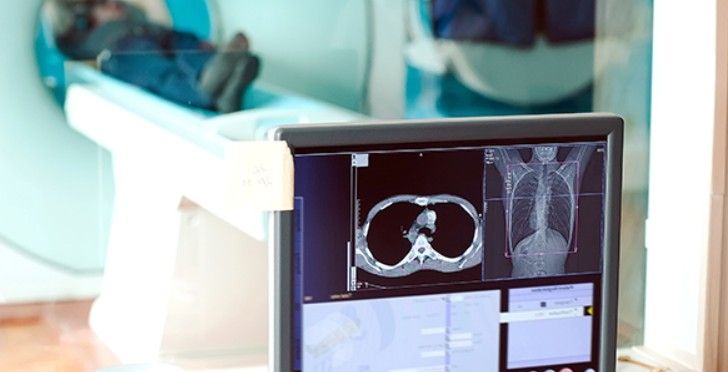 Comment la radiothérapie est-elle appliquée?