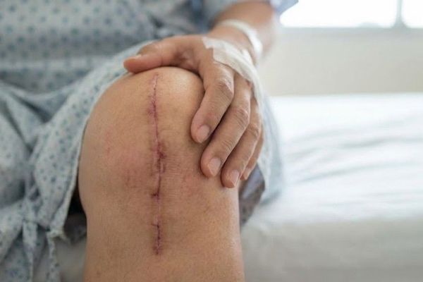 In Which Situations Is a Knee Replacement Necessary? In Which Situations Is a Knee Replacement Necessary?