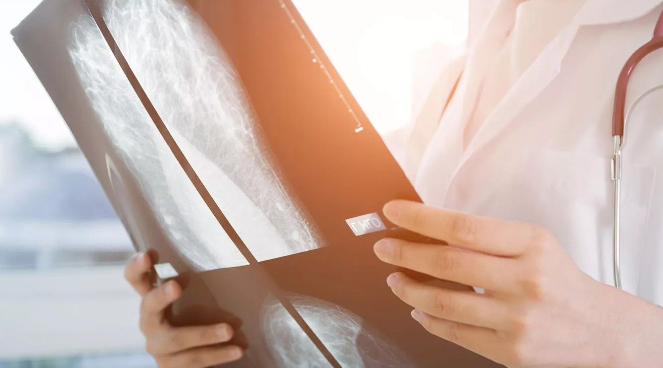 Comment se font les dépistages du cancer ?