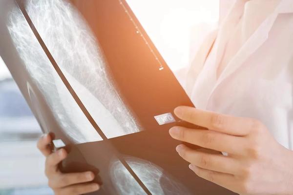 Comment se font les dépistages du cancer ?