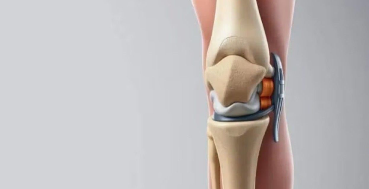 Is Knee Replacement Surgery Risky?