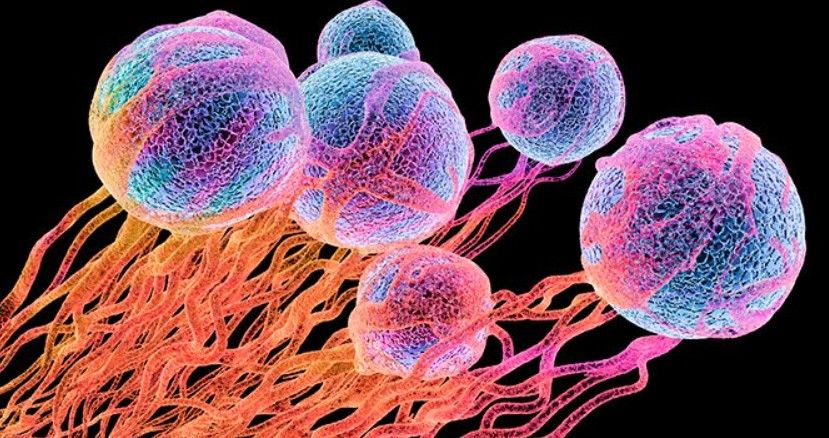 Comment Évaluer Les Facteurs De Risque Du Cancer?