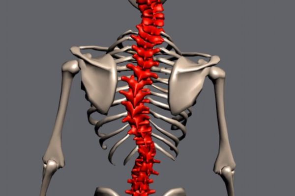 La scoliose provoque-t-elle une fatigue quotidienne ? La scoliose provoque-t-elle une fatigue quotidienne ?