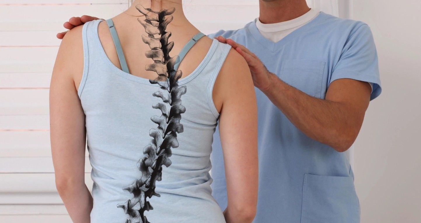 La scoliose peut-elle être contrôlée sans chirurgie ?