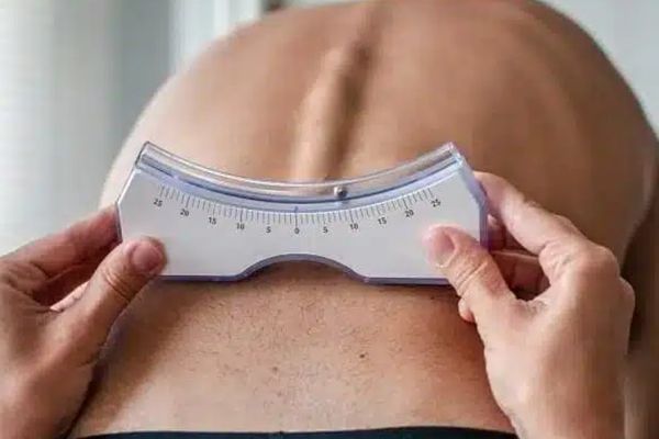 Est-il possible de ralentir la progression de la scoliose ? Est-il possible de ralentir la progression de la scoliose ?