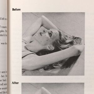 Cookie Mueller: How to Get Rid of Pimples