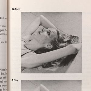 Cookie Mueller: How to Get Rid of Pimples