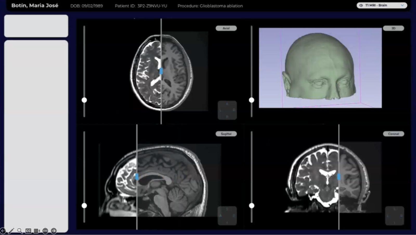 brain surgery GUI