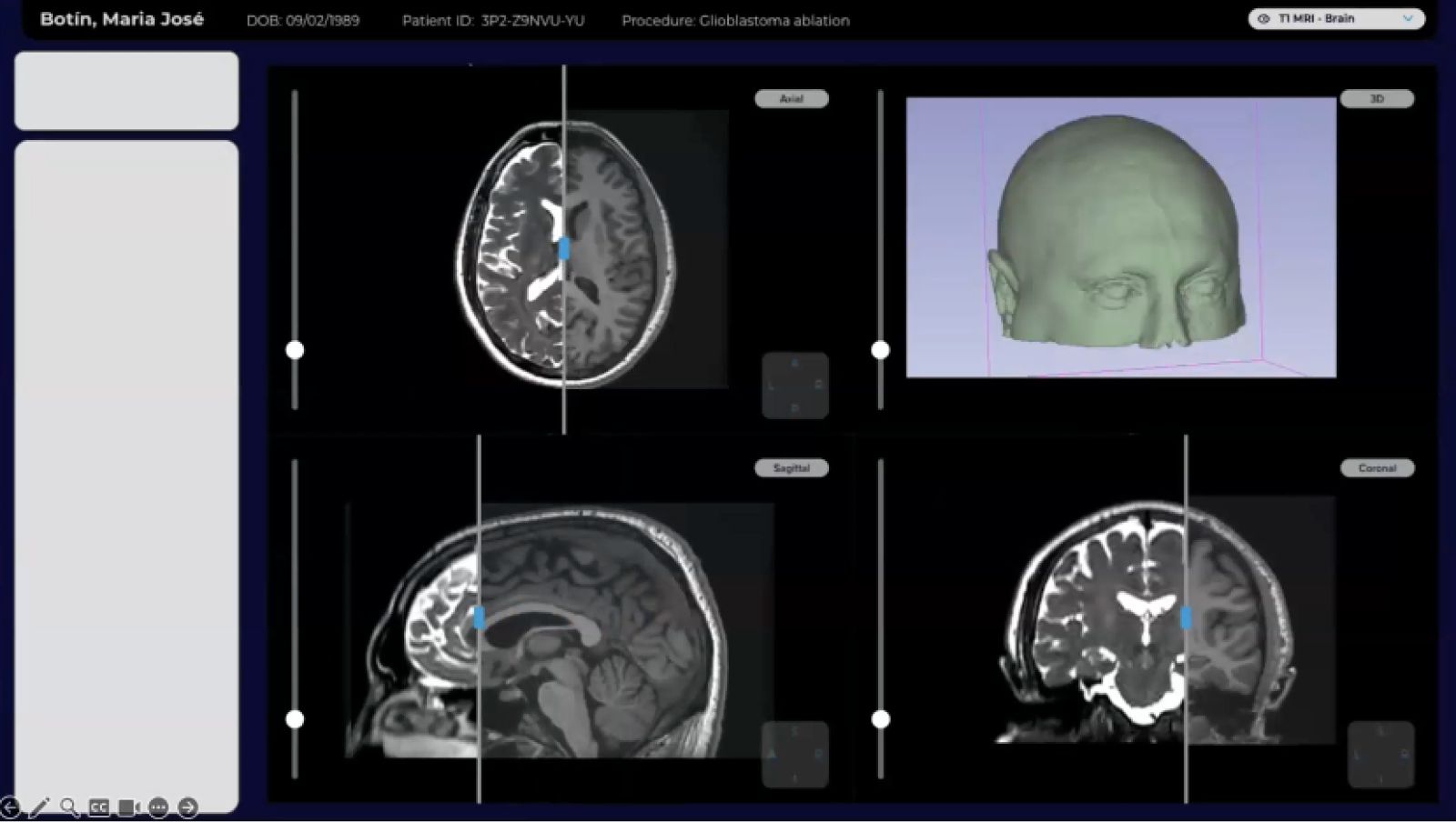 Building a brain surgery GUI in ProtoPie in just eight weeks.