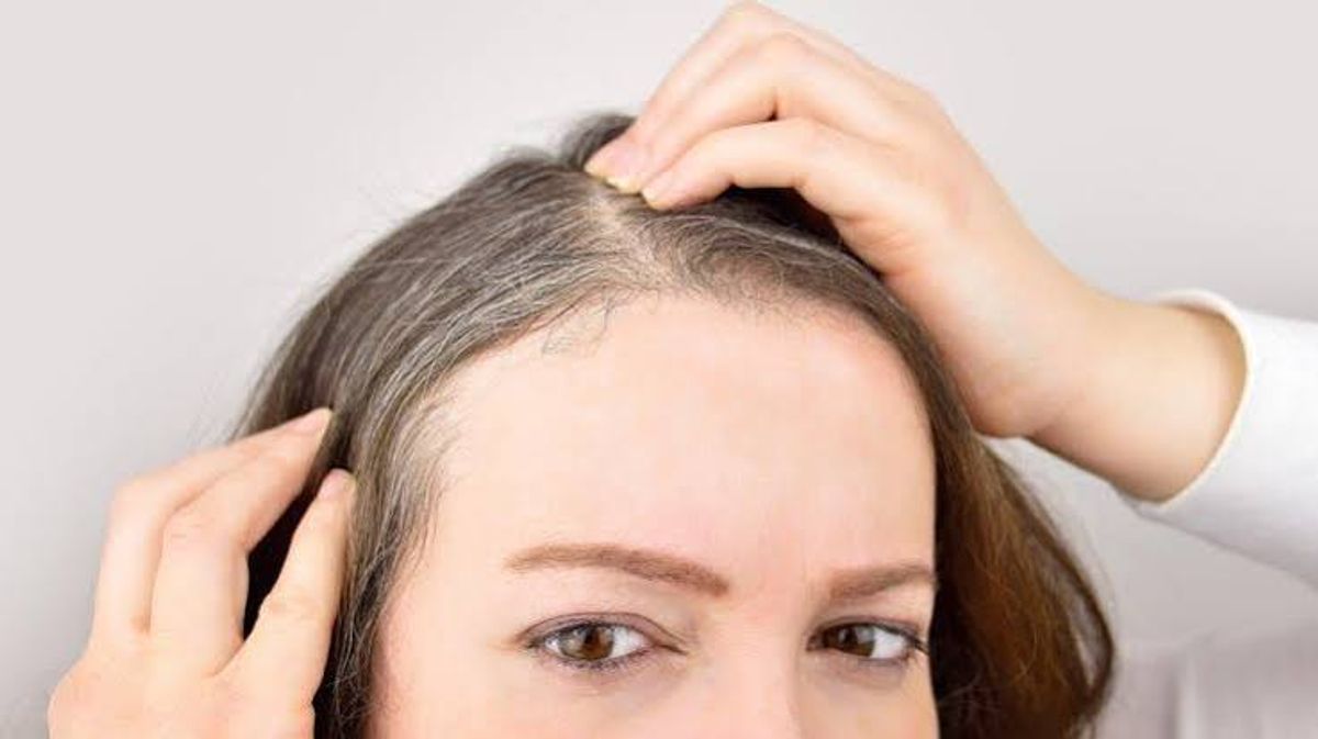 Stress gây rụng tóc 
