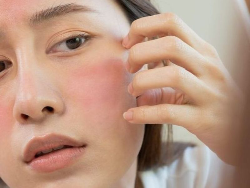 Da nhạy cảm khiến bạn khó chịu