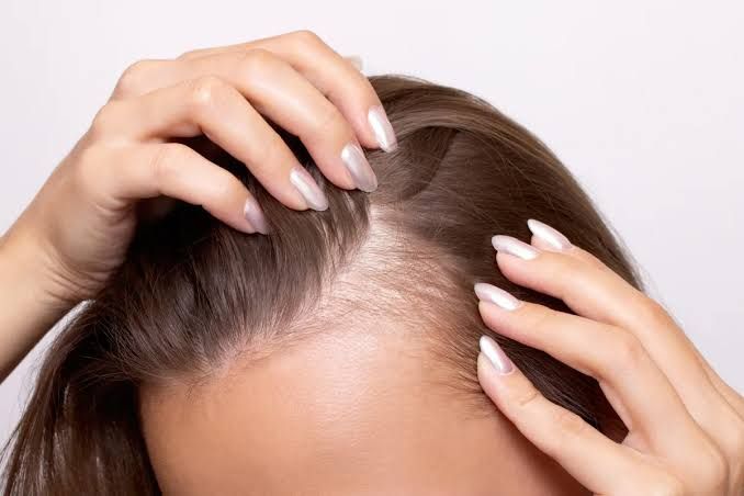 Tóc rụng thưa dần