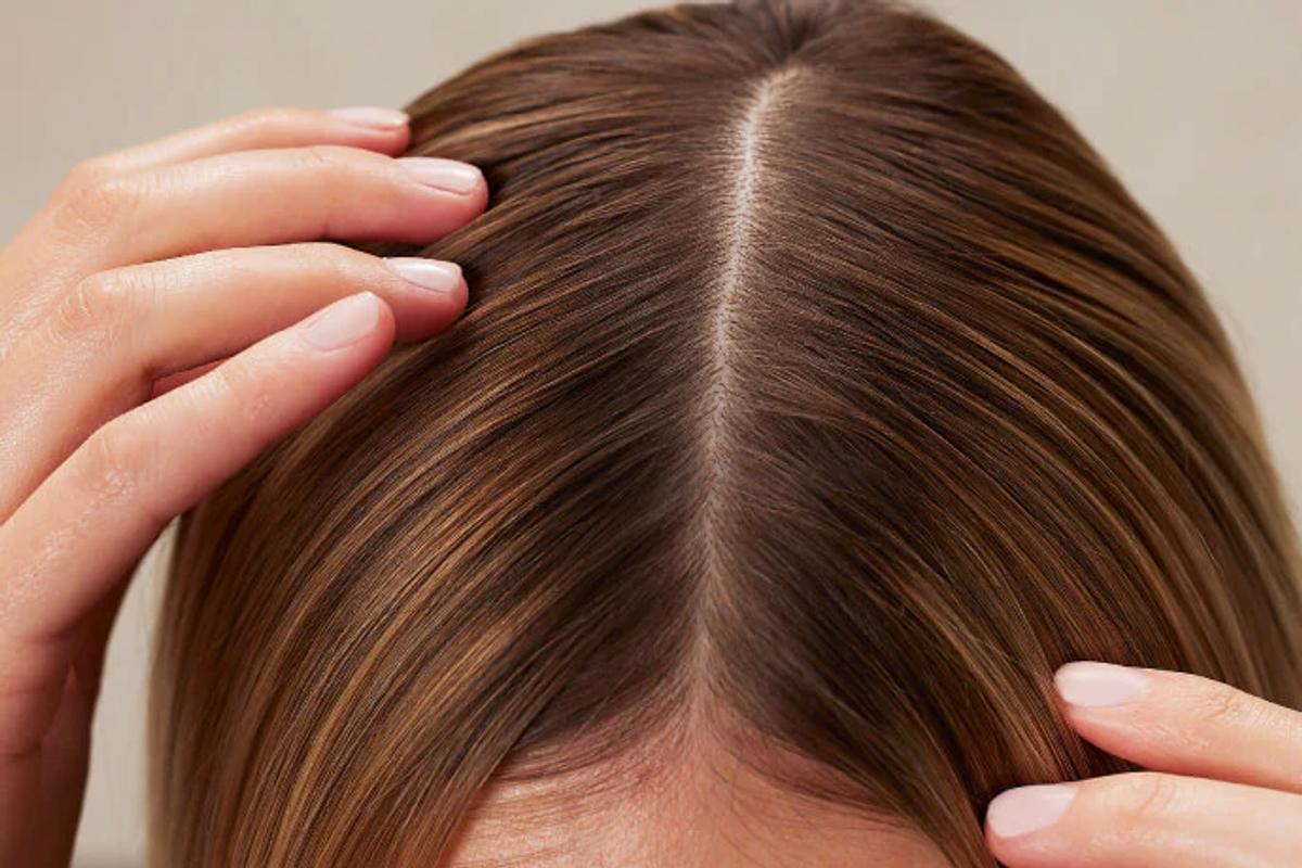 Tình trạng rụng tóc có mọc lại không