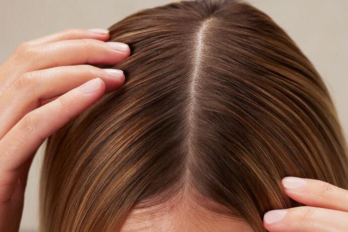 Tình trạng rụng tóc có mọc lại không